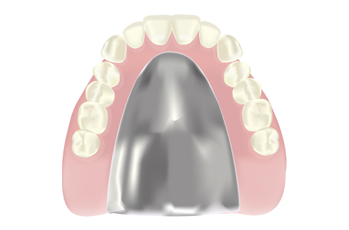チタン床義歯